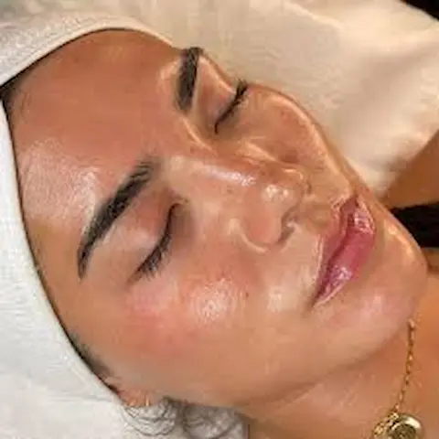Facial Deep Cleansing Komedo untuk Wanita Terpercaya di Bali