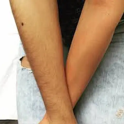 Layanan Hair Removal Waxing Tangan Lengkap Full Arm Wax Bali